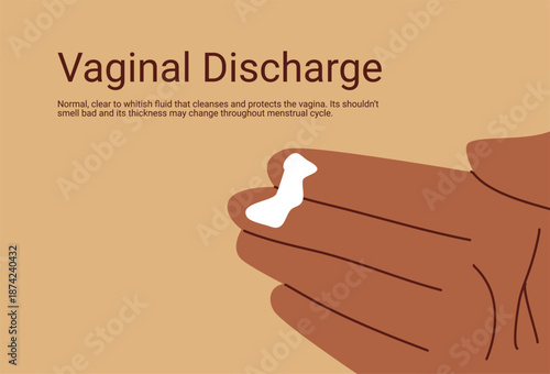 Vaginal discharge symptoms, medical concept of yeast infection, bacterial vaginosis and female reproductive health. Abnormal discharge vector illustration