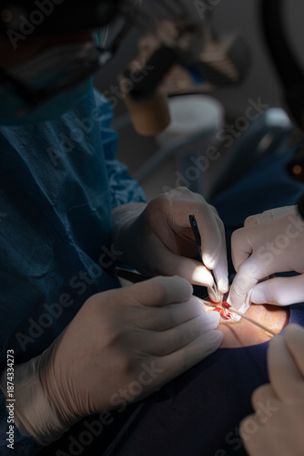 Macro close-up view of a plastic surgeon's hands using surgical scissors and forceps to cut and remove excess skin from a senior patient's eyelid during a cosmetic blepharoplasty operation.