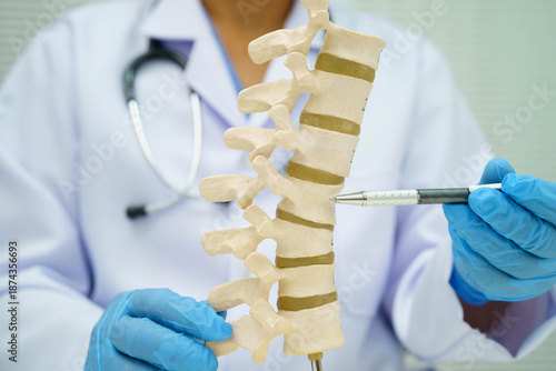 Foto Asian doctor holding spinal nerve and bone model, Lumbar spine displaced herniated disc fragment for treatment medical in the orthopedic department