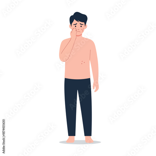 Young man with noticeable skin problems on his face and body, expressing discomfort and concern about his dermatological condition, isolated on a white background
