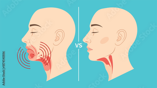 Profile view of a person before and after double chin removal or thyroid treatment showing significant reduction in neck and jaw area.