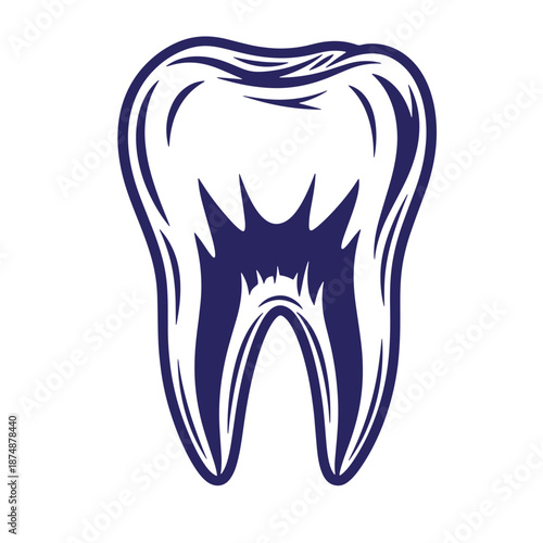 tooth illustration with cracked root and dark blue outline on transparent background