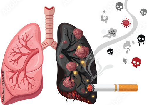 Healthy vs smoker lung comparison, cigarette damage, disease illustration, medical awareness graphic, anti-smoking visual, flat vector illustration