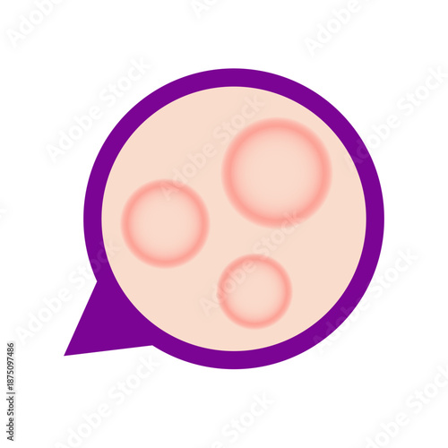 leprosy disease concept. vector illustration