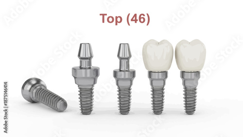 Dental implant screws and abutments with prosthetic teeth