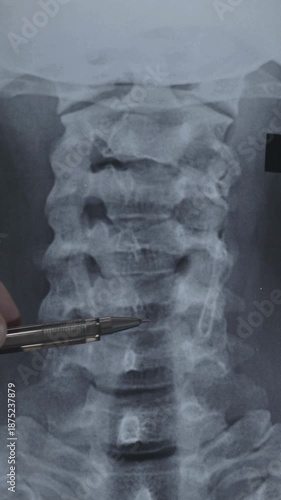 Vertical footage of scan Cervical spine examination. Pain in neck after work.