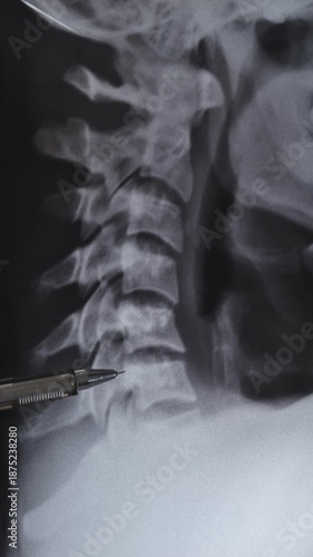 Healthy human neck scan. Vertical x-ray of vertebrae human cervical spine.