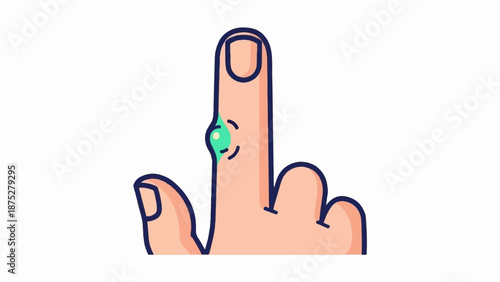 Cartoon hand with an inflamed, swollen finger, possibly a cyst or injury