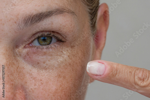Cuadro en lienzo Close-up of a middle-aged woman's eye with wrinkles, pointing at crow's feet