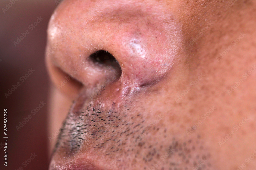 Fototapeta premium Close-Up View of Human Nose and Facial Hair with Natural Texture
