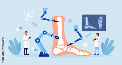 Robot arms operating healing foot, ankle joint. Robotic surgery. Machine surgeon and disease diagnostics. Lower extremity disease, rheumatism, osteoarthritis. Medical technologies innovation