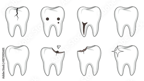 Medical diagram showing various dental conditions and tooth problems including cavities, cracks, and chips for patient education.