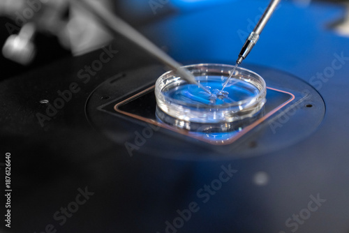 Photos Advanced ICSI procedure in IVF lab using micro manipulator and needle for human embryo fertilization under microscope, infertility treatment biotechnology and reproductive medicine laboratory process