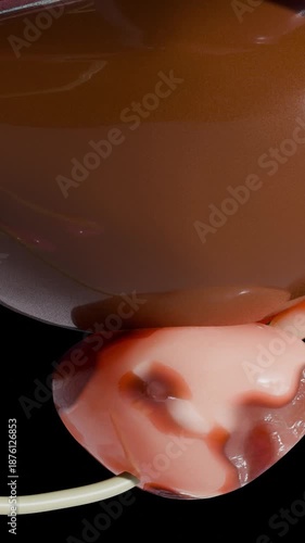 Prostate cancer stages. ancerous cells, malignant tumor compresses urethra. Pathological disruption, genital reproductive system anatomy, bladder Oncological or Urological Disease, bph, 3d render