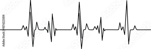 Black heartbeat line vector, clinical pulse wave frequency illustration, medical cardiology EKG or ECG trace isolated on white background for health concept design.