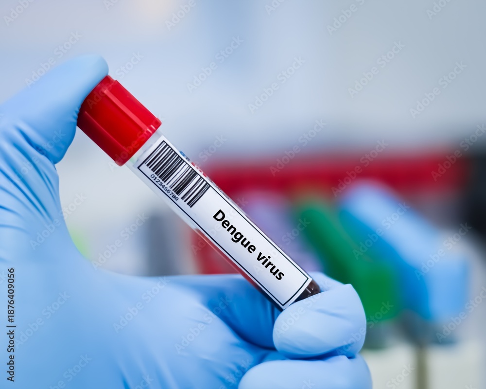 Fototapeta premium Blood sample tube for dengue virus test analysis.