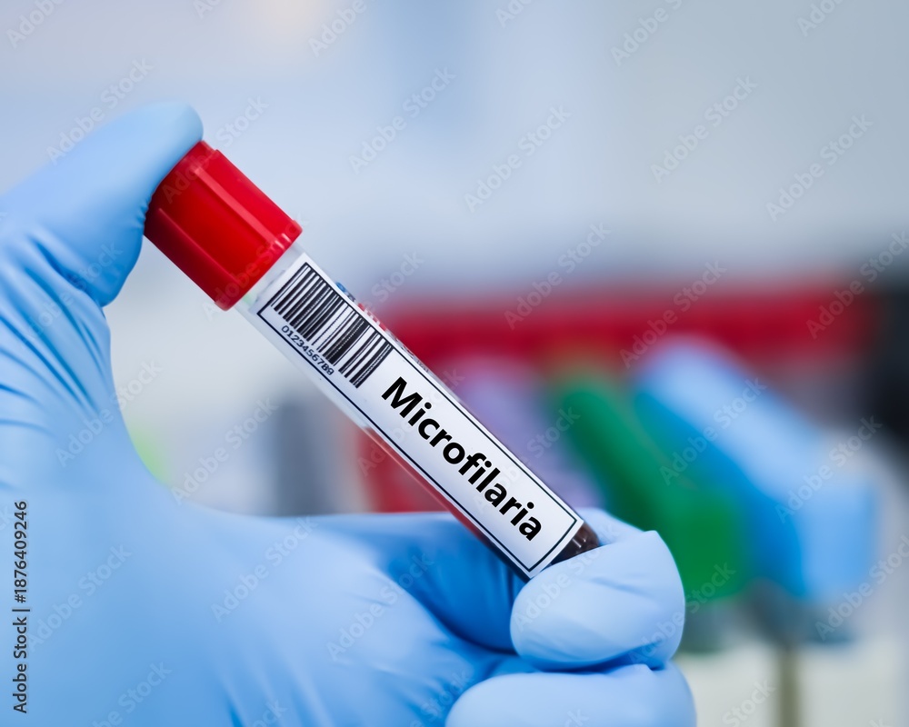 Fototapeta premium Blood sample tube for microfilaria test analysis.