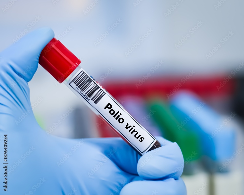 Obraz premium Blood sample tube for polio virus test analysis.