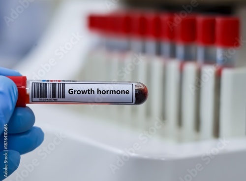 Blood sample tube for growth hormone test analysis.