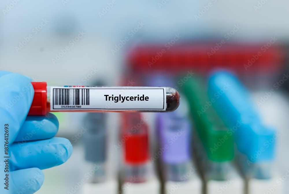 Fototapeta premium Blood sample tube for triglyceride test analysis.