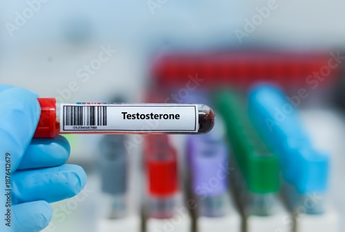 Blood sample tube for testosterone test analysis.