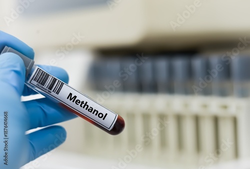 Blood sample tube for methanol test analysis.
