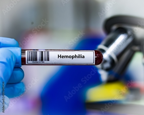 Blood sample tube for hemophilia test analysis.