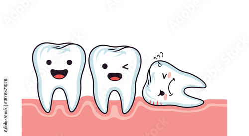 Cartoon illustration of teeth shows a painful and impacted wisdom tooth growing sideways against the neighboring molar in the jaw.