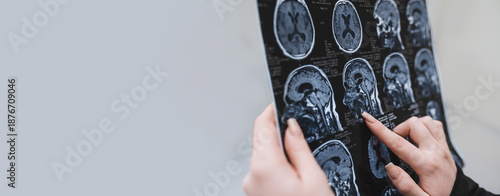 A close-up of a brain MRI scan held by a doctor. Modern diagnostics in neurology, neurosurgery, oncology, and endocrinology. Banner copy space