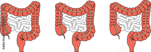 Human Digestive System Anatomy Illustration Set Showing Large Intestine and Colon Structure, Medical Healthcare Vector Isolated