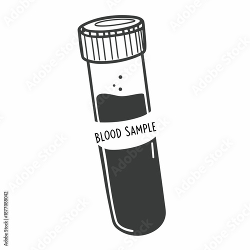 Blood sample in laboratory tube with white label and black lid  