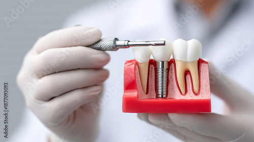 Dental procedure scene with dentist inserting implant using torque wrench tool