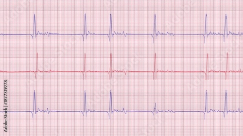 Spectral analysis graph