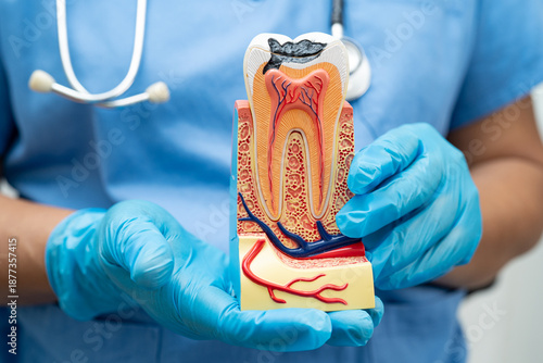 Dentist holding dental implant, artificial tooth roots into jaw, root canal of dental treatment, gum disease, teeth model for dentist.
