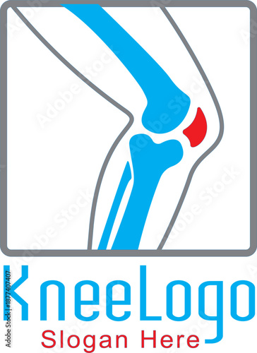 A detailed and accurate medical vector illustration of the human knee joint. This graphic highlights key anatomical structures including for orthopedic clinics, educational textbooks, healthcare prese