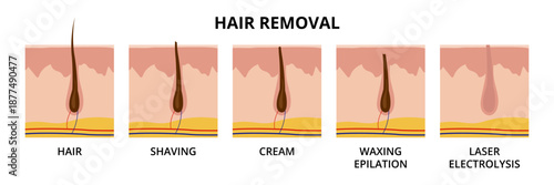 Hair removal methods. Hair, shaving, cream, waxing epilation, laser electrolysis