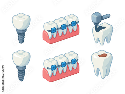 Dental Icon Grid. Dental treatment. Isometric flat vector icons set of Dental treatment: dental implant, braces, tooth filling. Arrange all isometric objects