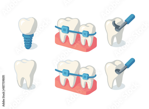 Dental Icon Grid. Dental treatment. Isometric flat vector icons set of Dental treatment: dental implant, braces, tooth filling. Arrange all isometric objects