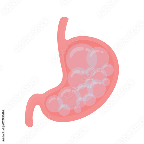 Human stomach with bloating. Abdominal distension, gas and digestive discomfort. Gastroenterology problem and digestive system concept. Flat vector illustration isolated on white background.