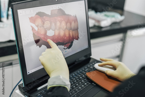 Close-up of a dentist pointing at a dental image on a laptop screen while explaining information during a professional consultation.