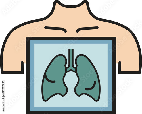 X-ray imaging of human lungs within a torso showing respiratory system for medical diagnosis