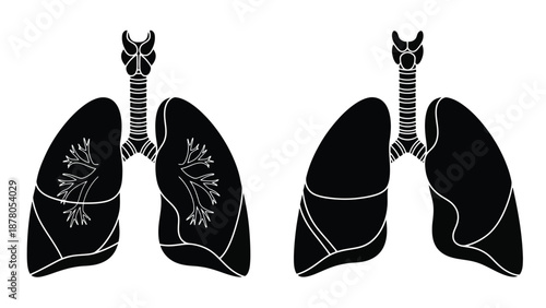 healthy lungs and lungs with pneumothorax condition