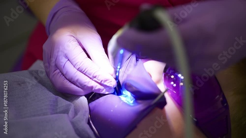 Bright lights illuminate a dental clinic as an expert carefully applies laser treatment.