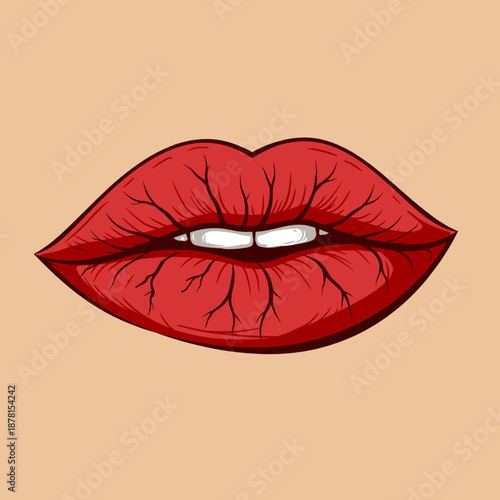 Dry Cracked Lips Cartoon Vector Illustration
