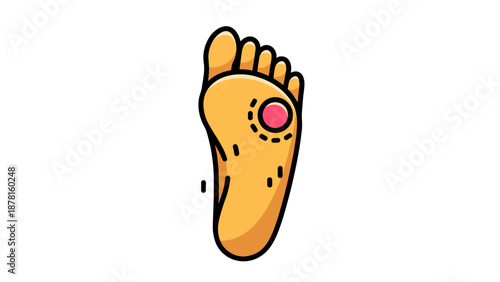 An anatomical illustration of a human foot sole featuring a prominent red mark, symbolizing a foot problem or condition.