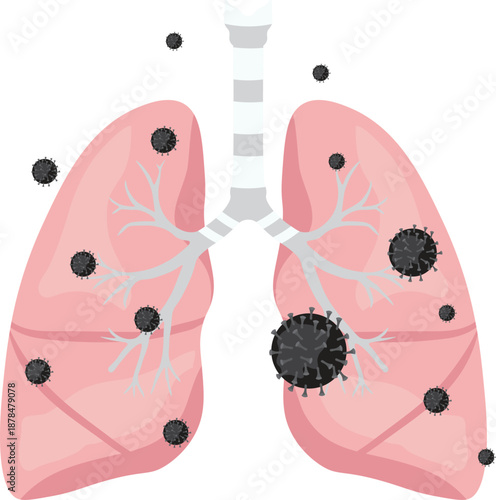 Illustration of infected lungs with viruses or bacteria showing respiratory infection