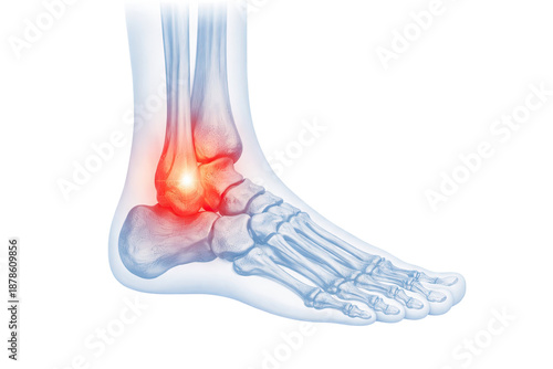 Human ankle joint anatomy showing tibia fibula talus calcaneus foot bones ligaments with highlighted pain isolated on white background