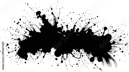 A detailed medical illustration showing a therapeutic kidney with surgical closure, catheter for dialysis,