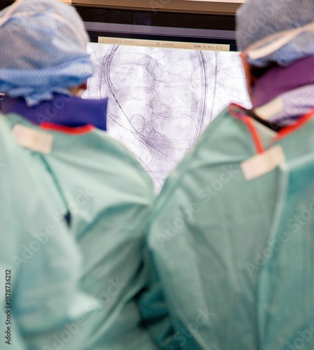 Foto TAVI (Transcatheter Aortic Valve Implantation)