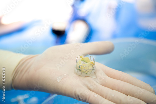 Vászonkép TAVI (Transcatheter Aortic Valve Implantation)